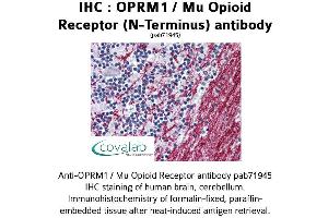 Image no. 1 for anti-Opioid Receptor, mu 1 (OPRM1) (N-Term) antibody (ABIN1737658) (Mu Opioid Receptor 1 antibody  (N-Term))