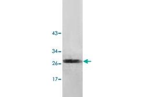 NUDT7 antibody  (AA 2-236)