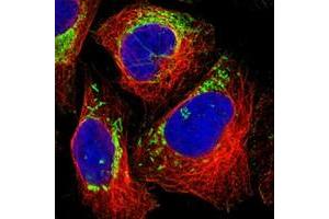 Immunofluorescent staining of human cell line U-2 OS with MRPL45 polyclonal antibody  at 1-4 ug/mL dilution shows positivity in mitochondria. (MRPL45 antibody)