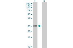 Western Blot analysis of FAM9C expression in transfected 293T cell line by FAM9C MaxPab polyclonal antibody. (FAM9C antibody  (AA 1-166))