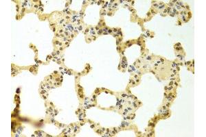 Immunohistochemistry of paraffin-embedded rat lung using HNRNPK Antibody. (HNRNPK antibody  (AA 1-280))