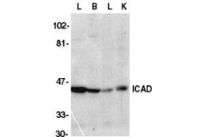 Western blot analysis of ICAD in mouse lung (L), brain (B), liver (L), and kidney tissue lysate with AP30399PU-N CAD antibody at 1/1000 dilution. (DFFA antibody  (C-Term))