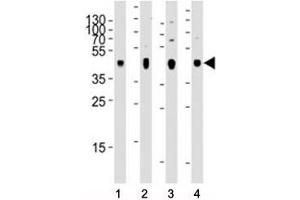 Western blot analysis of lysate from 1) human skeletal muscle, 2) human brain, 3) mouse brain, and 4) rat brain tissue using PDK2 antibody at 1:2000 for each lane. (PDK2 antibody)