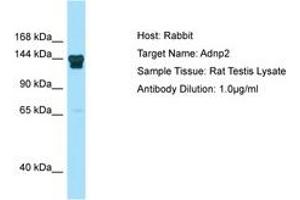 ADNP2 anticorps  (N-Term)
