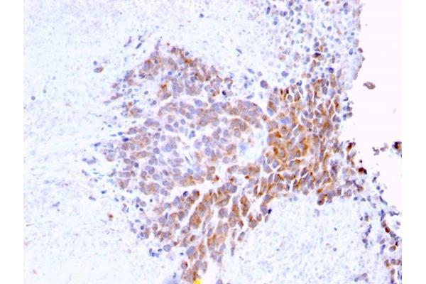 TOP1MT antibody