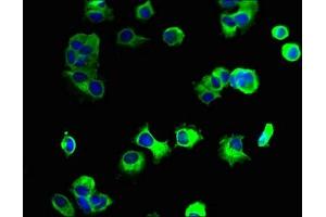 Immunofluorescent analysis of MCF-7 cells using ABIN7161370 at dilution of 1:100 and Alexa Fluor 488-congugated AffiniPure Goat Anti-Rabbit IgG(H+L) (GPM6A antibody  (AA 149-213))