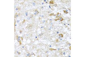 Immunohistochemistry of paraffin-embedded rat brain using ABCB8 antibody. (ABCB8 antibody)