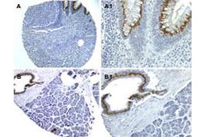 Formalin-fixed, paraffin-embedded sections of human colon (A, A1) and pancreas (B, B1) stained for NOD1 expression.
