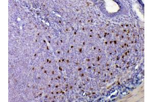 IHC analysis of IL33 using anti-IL33 antibody . (IL-33 antibody  (AA 102-264))