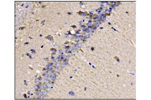 IHC analysis of Dynamin 3/DNM3 using anti-Dynamin 3/DNM3 antibody (ABIN7601163). (Dynamin 3 antibody  (AA 295-712))