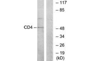 Western blot analysis of extracts from COLO205 cells, using CD4 (Ab-433) Antibody. (CD4 antibody  (AA 401-450))
