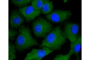 Immunofluorescence analysis of A549 cells using ARRB1 antibody (ABIN5996907). (beta Arrestin 1 antibody)