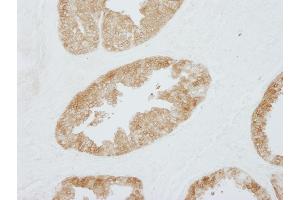 Immunohistochemistry (IHC) image for anti-Stratifin (SFN) (AA 198-248) antibody (ABIN7448925) (14-3-3 sigma/SFN antibody  (AA 198-248))