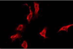 ABIN6276171 staining Hela by IF/ICC. (OR5K3 antibody  (Internal Region))