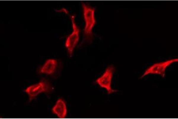 OR5K3 antibody  (Internal Region)