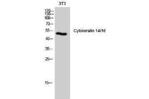 Western Blotting (WB) image for anti-Cytokeratin 14/16 (N-Term) antibody (ABIN3174693) (Cytokeratin 14/16 (N-Term) antibody)