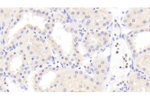 Detection of PCK2 in Human Kidney Tissue using Polyclonal Antibody to Phosphoenolpyruvate Carboxykinase 2, Mitochondrial (PCK2) (PEPCK antibody  (AA 33-198))