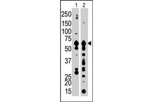 The PFKFB3 polyclonal antibody  is used in Western blot to detect PFKFB3 in Jurkat cell lysate (Lane 1) and mouse brain tissue lysate (Lane 2) . (PFKFB3 antibody  (C-Term))