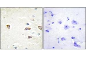 Immunohistochemistry analysis of paraffin-embedded human brain tissue, using MRCKB Antibody. (CDC42BPB antibody  (AA 1641-1690))