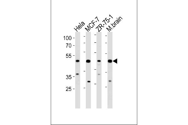 FBXO28 antibody  (C-Term)