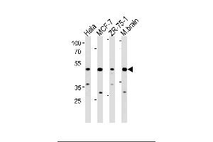FBXO28 Antibody (C-term) (ABIN1881338 and ABIN2843372) western blot analysis in Hela,MCF-7,ZR-75-1 cell line and mouse brain lysates (35 μg/lane).