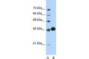 WB Suggested Anti-CDK6 Antibody Titration:  0. (CDK6 antibody  (C-Term))