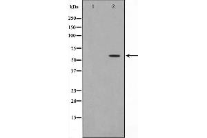 Western blot analysis on HeLa cell lysate using Dyskerin Antibody,The lane on the left is treated with the antigen-specific peptide. (DKC1 antibody  (Internal Region))