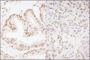 Immunohistochemistry (IHC) image for anti-cAMP Responsive Element Binding Protein 1 (CREB1) (AA 250-300) antibody (ABIN7453601)