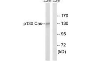 Western blot analysis of extracts from HuvEc cells, using p130 Cas (Ab-410) Antibody. (BCAR1 antibody  (AA 376-425))
