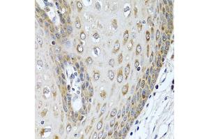 Immunohistochemistry of paraffin-embedded human esophagus using LRG1 antibody (ABIN5975207) at dilution of 1/100 (40x lens).