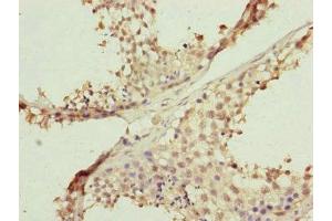 Immunohistochemistry of paraffin-embedded human testis tissue using ABIN7152484 at dilution of 1:100 (FBXL5 antibody  (AA 1-310))