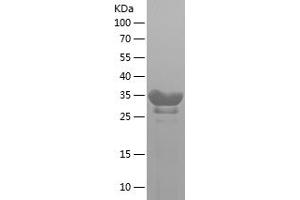 Western Blotting (WB) image for Immunoglobulin J Polypeptide, Linker Protein For Immunoglobulin alpha and mu Polypeptides (IGJ) (AA 40-89) protein (His-IF2DI Tag) (ABIN7123406) (IGJ Protein (AA 40-89) (His-IF2DI Tag))