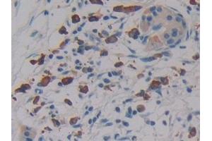 Immunohistochemistry (IHC) image for anti-Linker For Activation of T Cells Family, Member 2 (LAT2) (AA 30-209) antibody (ABIN7439774)