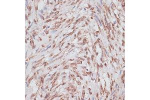 Immunohistochemistry of paraffin-embedded human uterus using RP/RP/RP antibody (ABIN6128653, ABIN6147083, ABIN6147084 and ABIN6214011) at dilution of 1:100 (40x lens). (RPA1 antibody  (AA 1-240))
