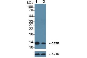 Knockout Varification: ;Lane 1: Wild-type HepG2 cell lysate; ;Lane 2: CSTB knockout HepG2 cell lysate; ;Predicted MW: 11kDa ;Observed MW: 14kDa;Primary Ab: 2µg/ml Rabbit Anti-Human CSTB Antibody;Second Ab: 0. (CSTB antibody  (AA 1-98))