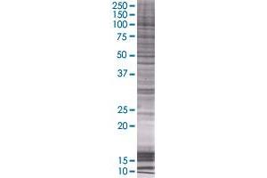 Western Blotting (WB) image for PLOD2 293T Cell Transient Overexpression Lysate(Denatured) (ABIN1332994)