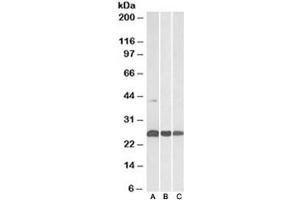 Western blot testing of human [A], mouse [B] and rat [C] heart lysates with DUSP6 antibody at 0. (DUSP6 antibody)