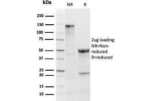 SDS-PAGE Analysis Purified TPO Recombinant Rabbit Monoclonal Antibody (TPO/3813R). (Recombinant TPO (AA 685-804) antibody)