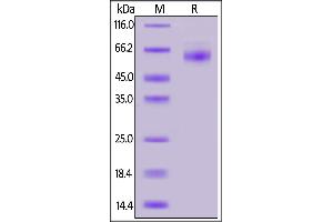 2019-nCoV (COVID-19) Nucleocapsid protein, His Tag on SDS-PAGE under reducing (R) condition.