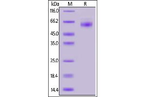 SARS-CoV-2 Nucleocapsid Protein (SARS-CoV-2 N) (His tag)