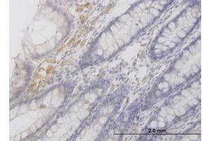 Immunoperoxidase of monoclonal antibody to RAB42 on formalin-fixed paraffin-embedded human colon. (RAB42 antibody  (AA 46-105))