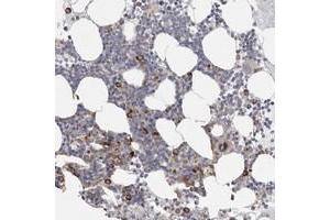 Immunohistochemical staining of human bone marrow with FBXO43 polyclonal antibody  shows strong cytoplasmic positivity in subsets of bone marrow poietic cells. (FBXO43 antibody)