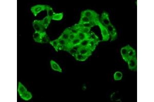 Detection of TTK in MCF7 cells using Polyclonal Antibody to TTK Protein Kinase (TTK) (Mps1 antibody  (AA 532-786))