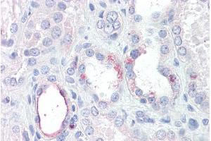 ABIN570885 (3. (RHBG antibody  (Internal Region))
