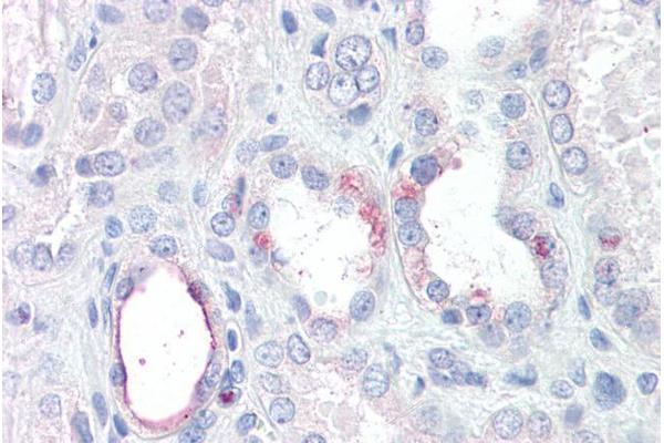RHBG antibody  (Internal Region)