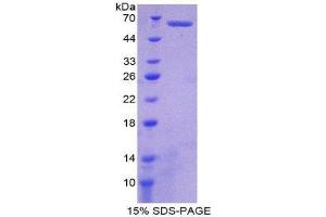 SDS-PAGE (SDS) image for Ephrin B2 (EFNB2) (AA 42-333) protein (His tag,GST tag) (ABIN2122785)