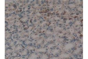 Immunohistochemistry (IHC) image for anti-Microfibrillar Associated Protein 2 (MFAP2) (AA 8-171) antibody (ABIN7442705)