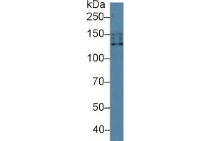 Detection of NCCT in Human 293T cell lysate using Polyclonal Antibody to Na-Cl Cotransporter (NCCT) (SLC12A3 antibody  (AA 3-146))