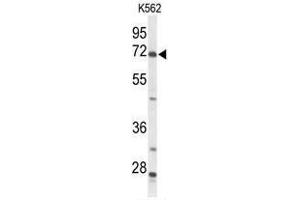 Western blot analysis of ACSS2 Antibody (N-term) in K562 cell line lysates (35 µg/lane).