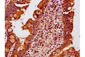IHC image of ABIN7159553 diluted at 1:400 and staining in paraffin-embedded human small intestine tissue performed on a Leica BondTM system. (MTSS1 antibody  (AA 616-730))